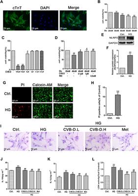 Cyclovirobuxine D Ameliorates Experimental Diabetic Cardiomyopathy by Inhibiting Cardiomyocyte Pyroptosis via NLRP3 in vivo and in vitro